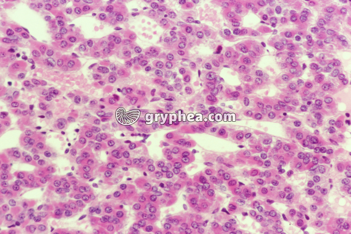 Hypophyse antérieure x100 - gryphea.com